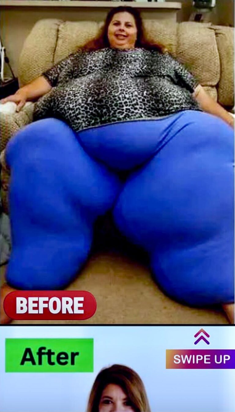 10 Of The Biggest Weight Loss Transformations Of All Time
