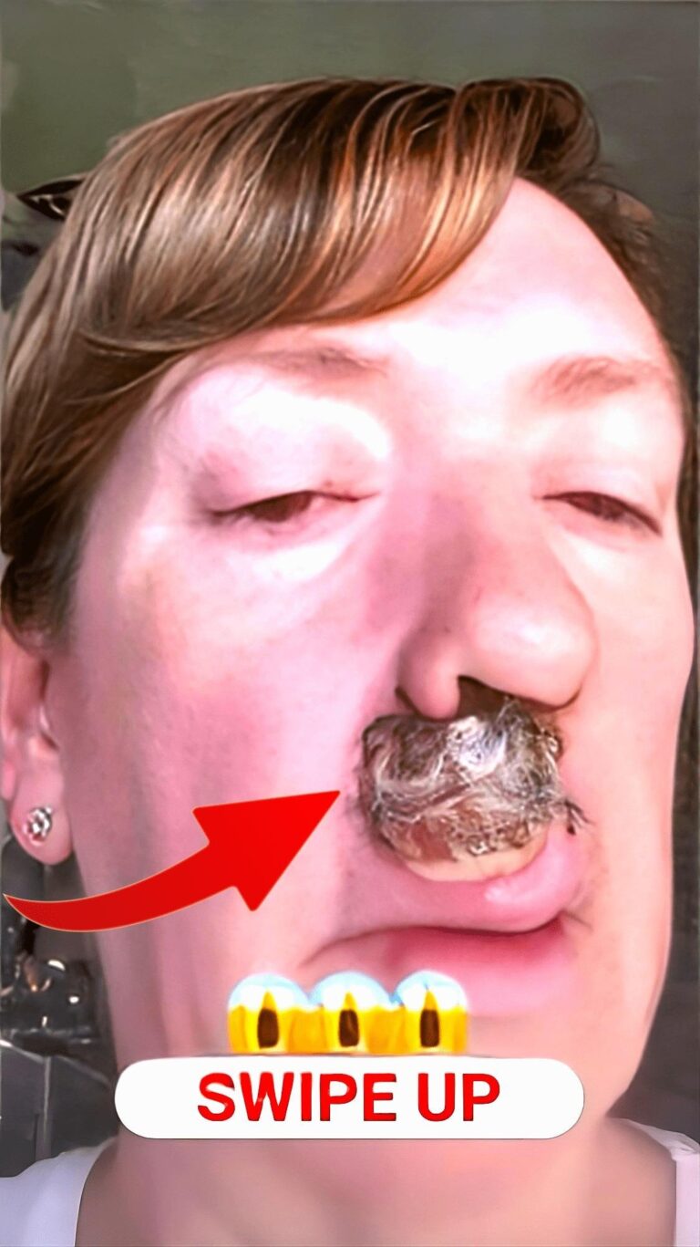 SERIOUS Diseases Diagnosed Via Skin Signals!